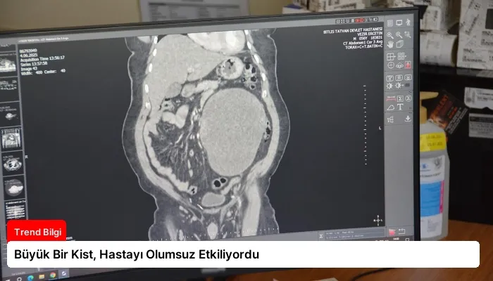 Büyük Bir Kist, Hastayı Olumsuz Etkiliyordu