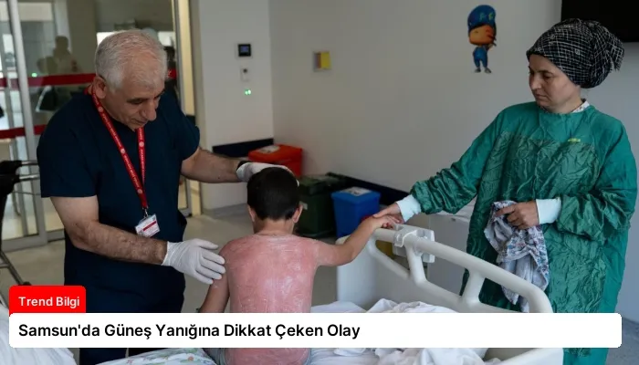 Samsun’da Güneş Yanığına Dikkat Çeken Olay