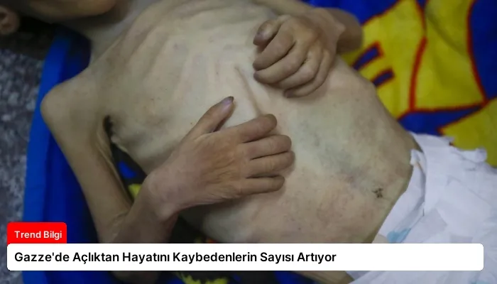 Gazze’de Açlıktan Hayatını Kaybedenlerin Sayısı Artıyor