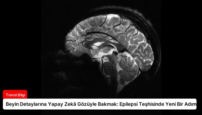 Beyin Detaylarına Yapay Zekâ Gözüyle Bakmak: Epilepsi Teşhisinde Yeni Bir Adım