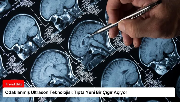 Odaklanmış Ultrason Teknolojisi: Tıpta Yeni Bir Çığır Açıyor