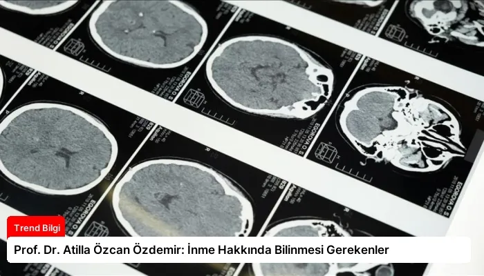 Prof. Dr. Atilla Özcan Özdemir: İnme Hakkında Bilinmesi Gerekenler