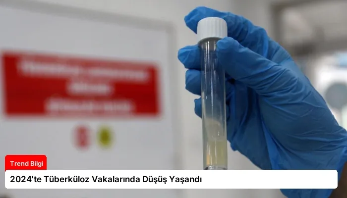 2024’te Tüberküloz Vakalarında Düşüş Yaşandı