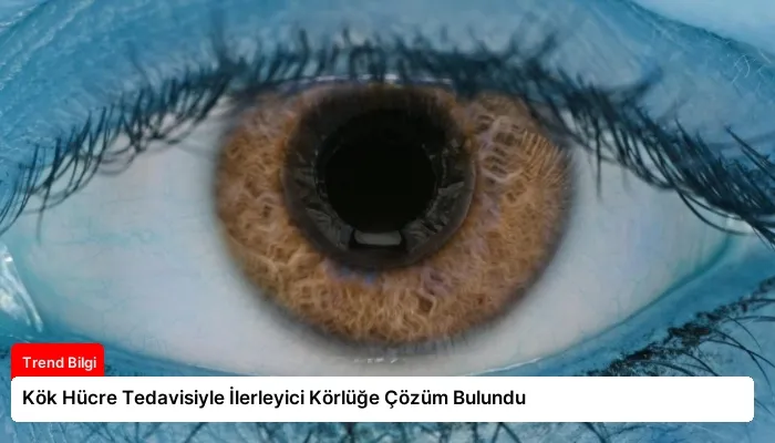 Kök Hücre Tedavisiyle İlerleyici Körlüğe Çözüm Bulundu